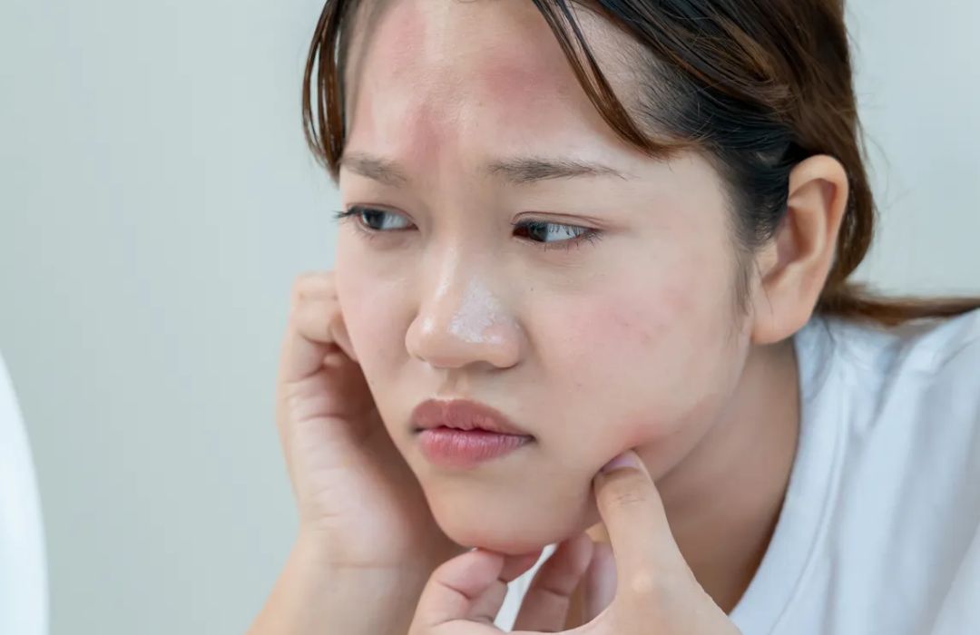 아침에 얼굴 붓는 이유를 확인하는 모습