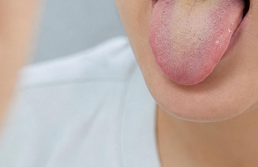 혀끝이 따끔거려 거울로 혀 상태를 확인하는 사람